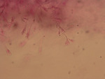 MISSING THUMBNAIL